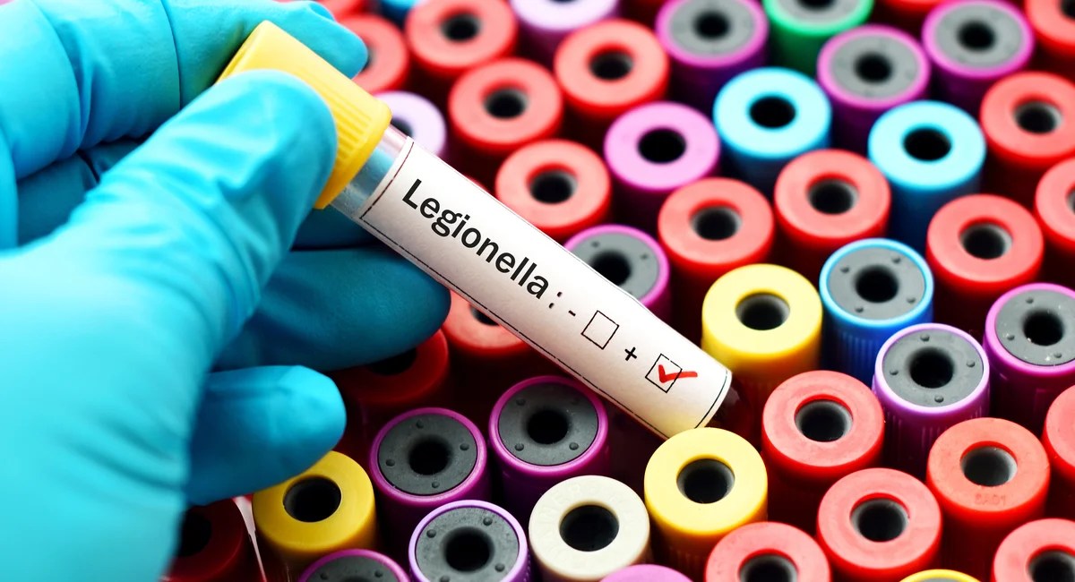 Legionnaires' Disease Outbreak on NYC's Upper East Side: What You Need to Know (2026)